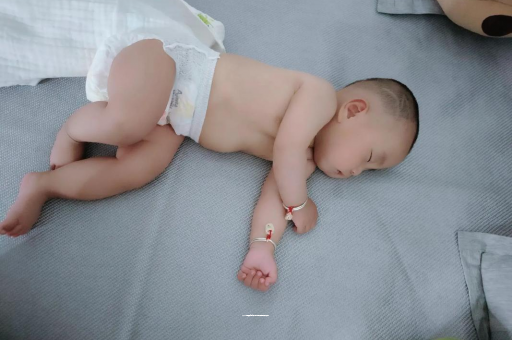 汉中六个月宝宝眼睛散光